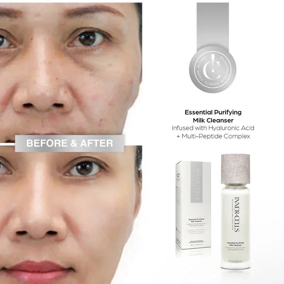 Inner Cells
Essential Purifying Milk Cleanser - Picture 3 of 6